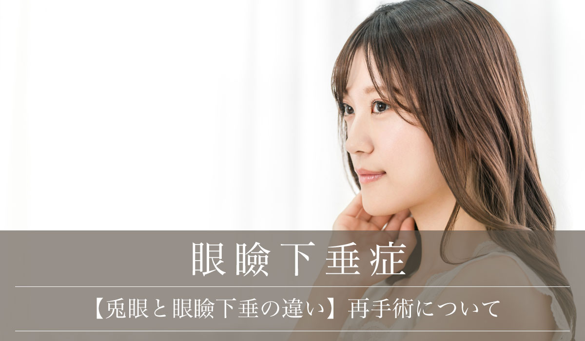 【兎眼と眼瞼下垂の違い】再手術について