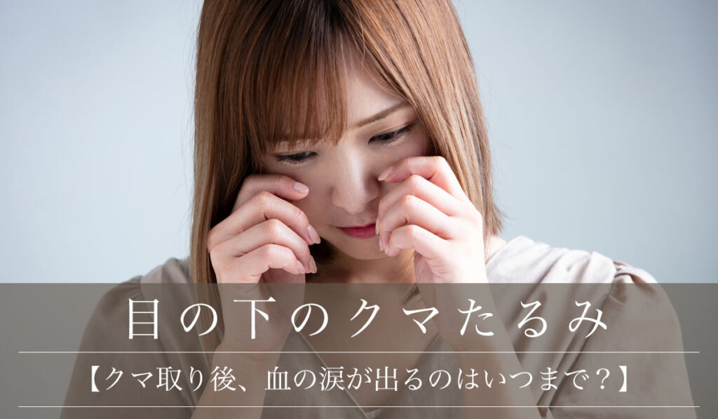 【クマ取り後、血の涙が出るのはいつまで？】原因と対処法・コンタクト使用について