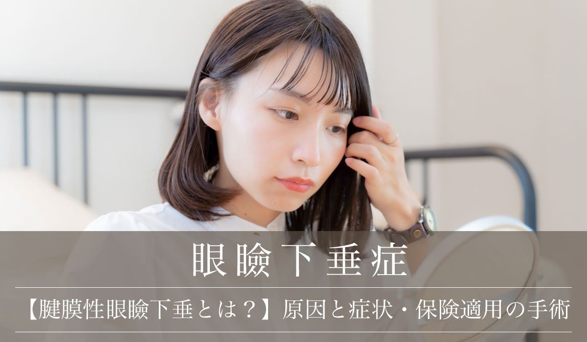【腱膜性眼瞼下垂とは?】原因と症状・保険適用の手術