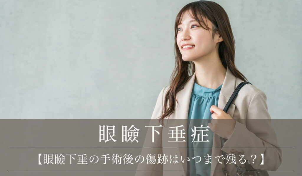 【眼瞼下垂の手術後の傷跡はいつまで残る？】クリームは使っても良いか解説