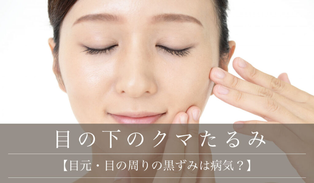 【目元・目の周りの黒ずみは病気?】主な原因と症状・ケアする方法と治し方