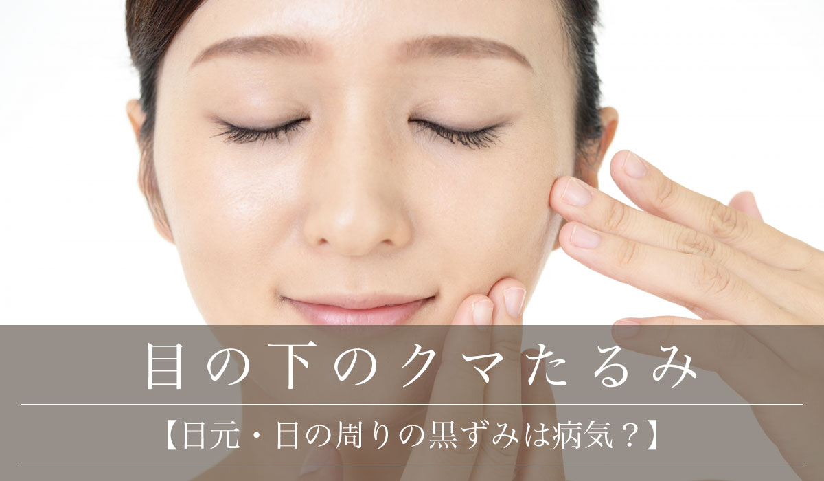 【目元・目の周りの黒ずみは病気?】