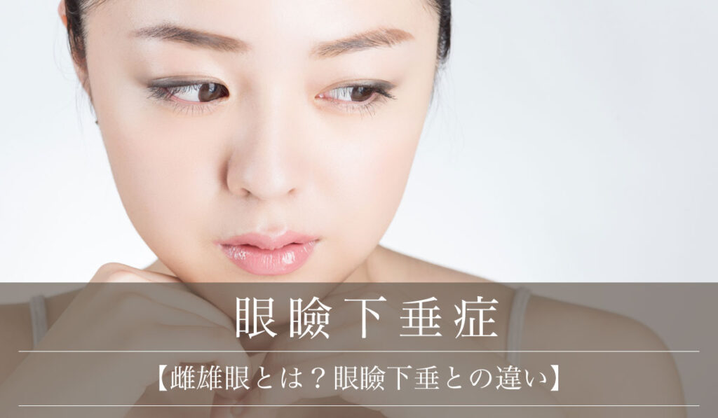【雌雄眼とは?眼瞼下垂との違い】目の左右差がある原因と改善方法