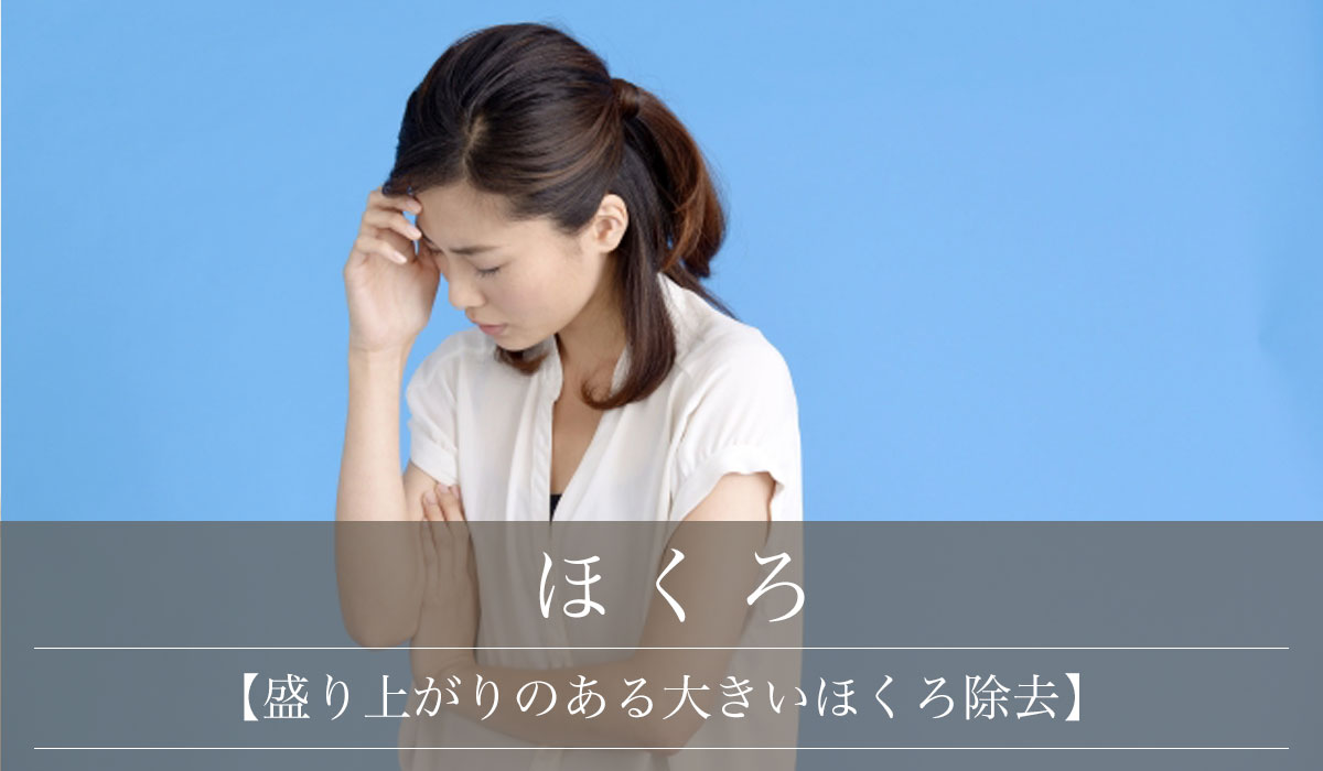 【盛り上がりのある大きいほくろ除去】